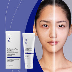 Acne Cleanser for Gentle Pore Cleansing and Hydrating Skin Care