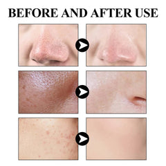Blackhead Removing Mud Mask for Deep Cleansing and Oil Control
