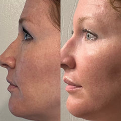 Collagen Cream Moisturizer