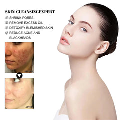 Blackhead Removing Mud Mask for Deep Cleansing and Oil Control