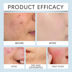 Hyaluronic Acid Face Serum for Hydrating Radiant Skin Care
